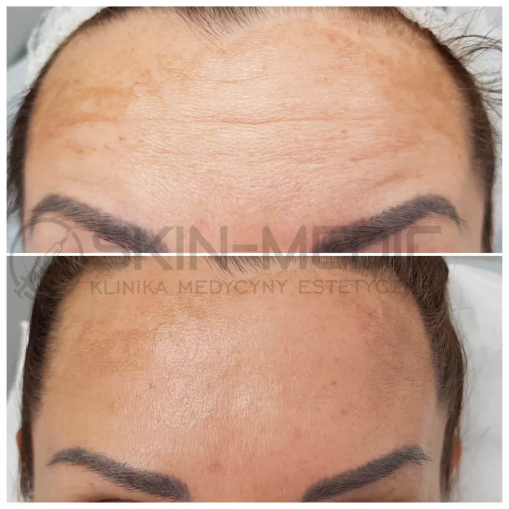 Medycyna Estetyczna Poznan Skin Medic