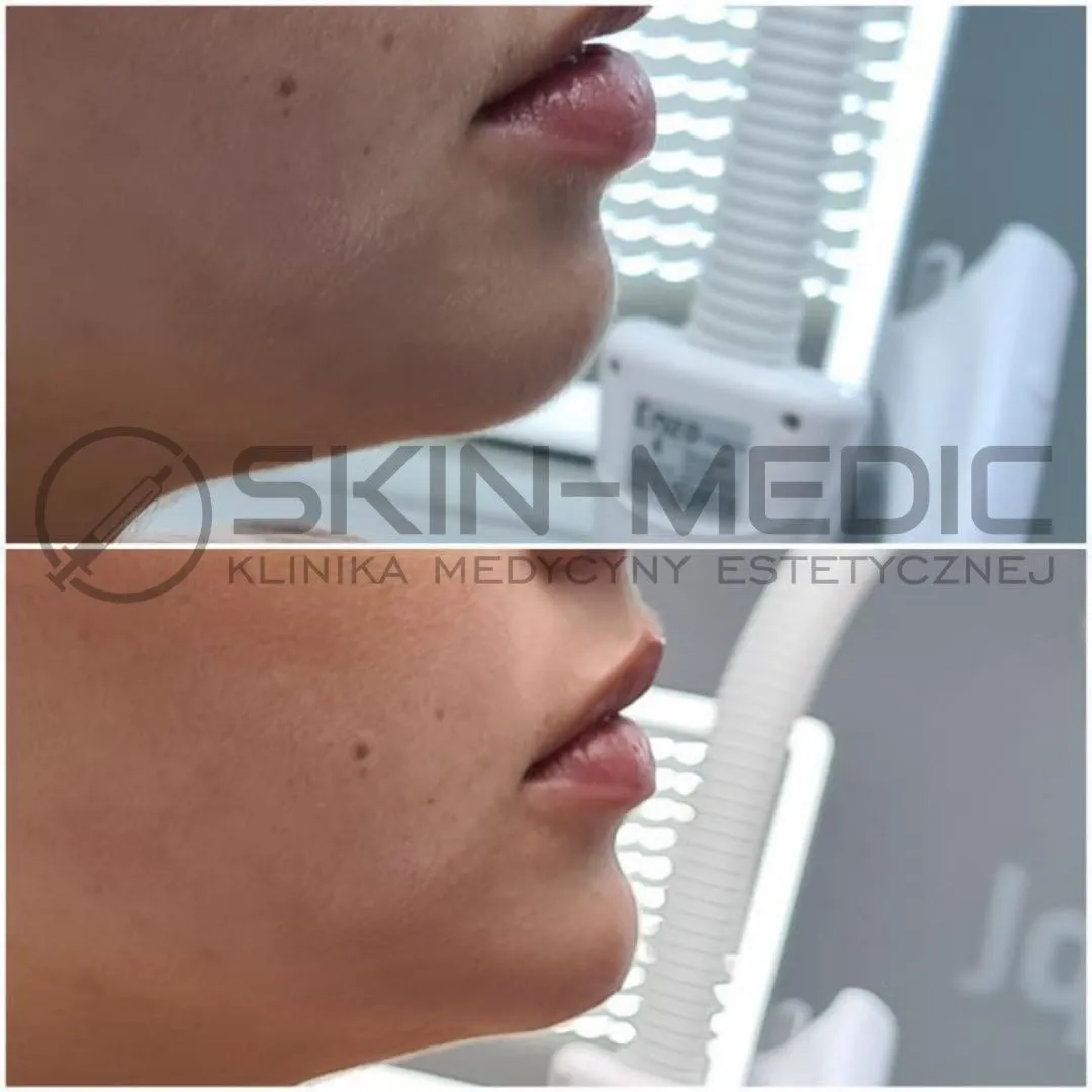 Efekt modelowania brody 