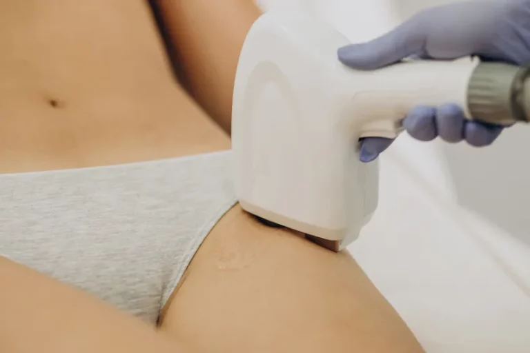 bikini po depilacji laserowej