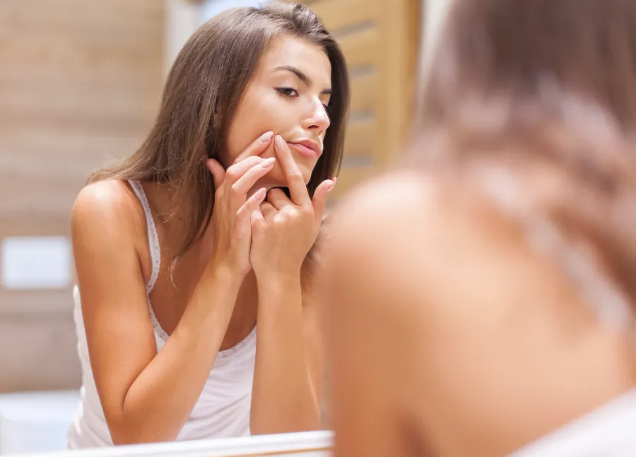 Czy zaskórniki powinno się wyciskać